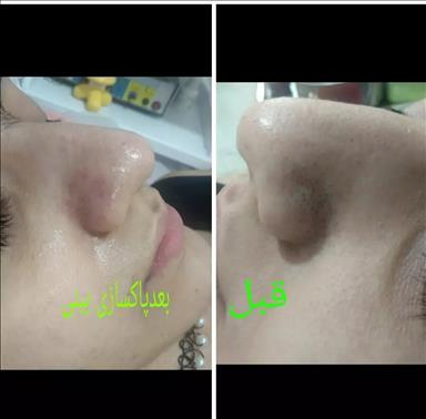 سالن زیبایی پنجه ی آفتاب  در  بندر انزلی