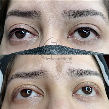 سالن زیبایی میکروبلیدینگ ریحانه جلالی  در  مشهد